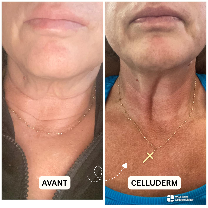 Derma+ Huile massage anti-cellulite