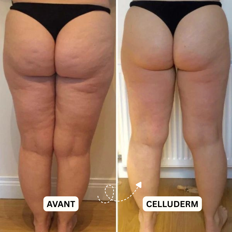 Derma+ Huile massage anti-cellulite